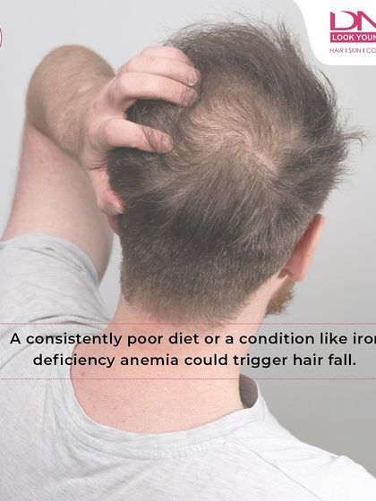 A consistently poor diet or a condition like iron-deficiency anemia can be a direct trigger for hair fall. What you eat has a direct impact on the health and strength of your hair.