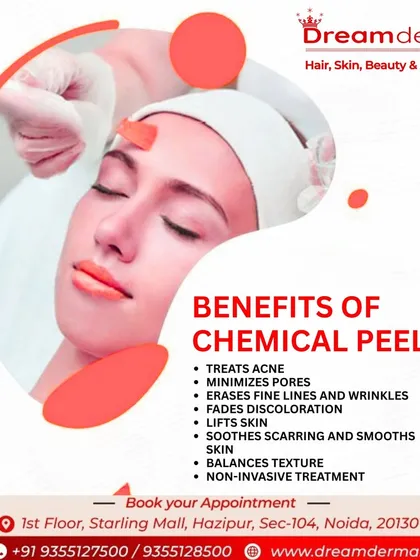 This graphic details the extensive benefits of a chemical peel. It not only treats acne and minimizes pores but also lifts the skin, soothes scarring, and balances texture, all through a non-invasive procedure.