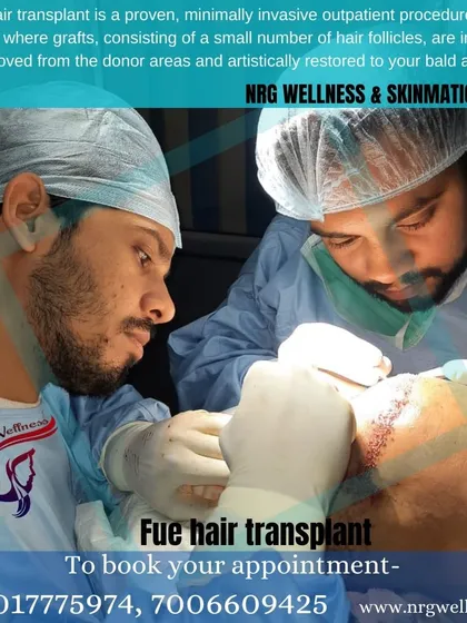 Your procedure is handled by our expert team of dermatologists and surgeons in a sterile, clinical environment. Here you can see our team meticulously performing a Follicular Unit Extraction, ensuring each graft is placed perfectly for a natural result.