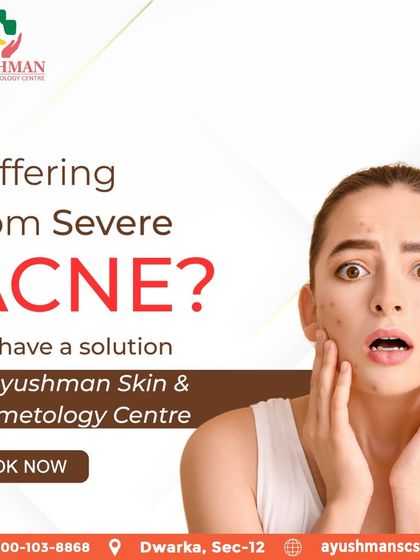 If you're suffering from severe acne, know that there are solutions. I specialize in creating advanced treatment plans to tackle even the most stubborn breakouts.