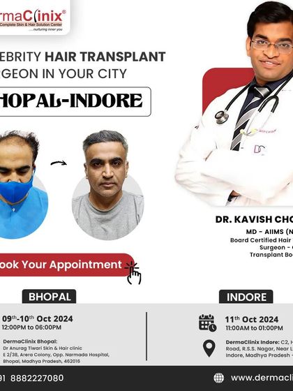 An announcement for my availability for hair transplant consultations in Bhopal and Indore.