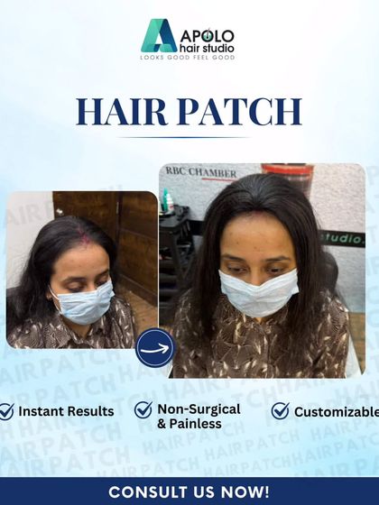 This client needed a solution for her receding and thinning hairline. Our customizable, non-surgical hair patch provided instant, painless results, giving her a fuller look while she wears a mask.