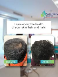 Hair Restoration & Removal