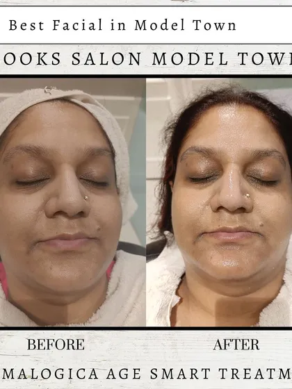 Real, visible results are what we promise. This before and after showcases the power of a single Dermalogica Age Smart Treatment, revealing brighter, smoother, and more youthful-looking skin.