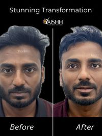 Cosmetic Injectables