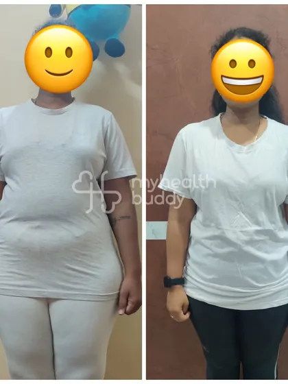 Front view of the same postpartum transformation, celebrating a healthier lifestyle and renewed confidence.