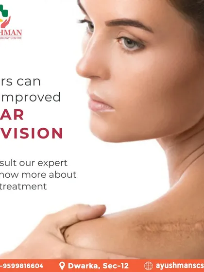 Scars can be significantly improved with the right approach. I encourage you to consult with me to learn more about my expert scar revision treatments.