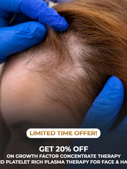 A close-up view of a scalp with visible thinning, a common concern we treat. Our GFC and PRP therapies are designed to target such areas, using your body's own growth factors to promote regrowth.