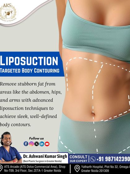 This graphic illustrates the principle of liposuction: a targeted body contouring technique to remove stubborn fat from specific areas like the abdomen, hips, and arms to achieve a sleeker shape.