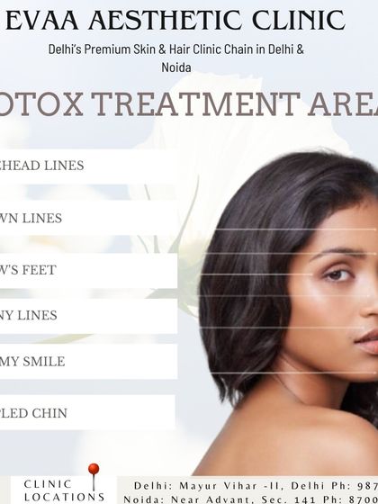An informational graphic detailing the common treatment areas for Botox. We address concerns such as forehead lines, frown lines, crow's feet, and even a gummy smile for a balanced, natural result.