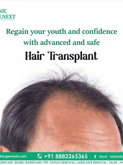 Regain your youth and confidence with an advanced and safe hair transplant procedure at my clinic.