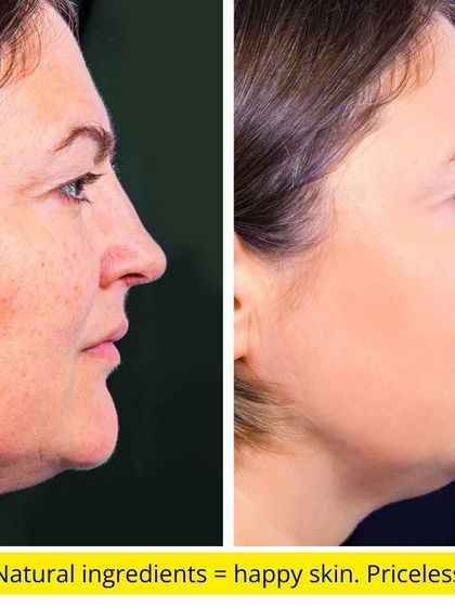 The results of using natural ingredients speak for themselves. Achieving happy, healthy skin is priceless.