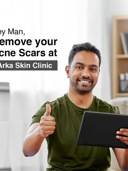 Taking care of your skin is a sign of self-respect. For men dealing with acne scars, I offer specific treatments designed to address scarring and improve skin texture for a smoother appearance.
