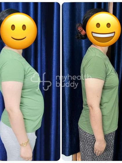 Side view showing the significant change in posture and body shape after losing 10kg.