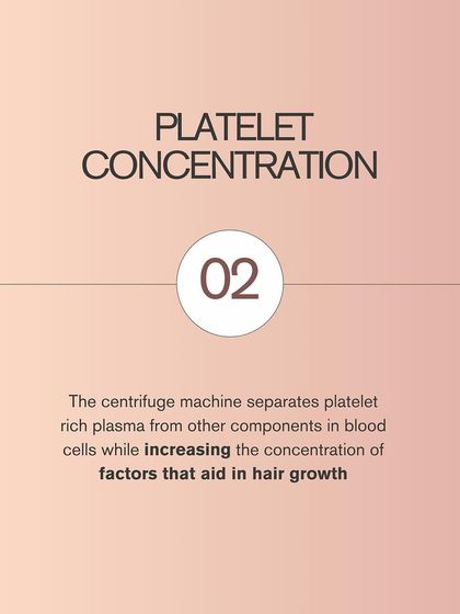 Next is platelet concentration. The centrifuge machine spins the blood sample at high speed, separating the plasma and concentrating the platelets. This process significantly increases the concentration of growth factors that are vital for hair follicle stimulation.