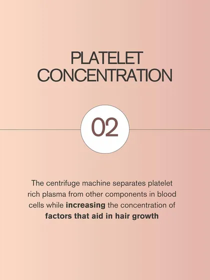 Next is platelet concentration. The centrifuge machine spins the blood sample at high speed, separating the plasma and concentrating the platelets. This process significantly increases the concentration of growth factors that are vital for hair follicle stimulation.