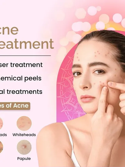 I offer a range of acne treatments depending on the type of acne, from blackheads and whiteheads to cysts. Options include laser treatments, chemical peels, and oral medications.
