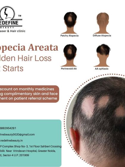 A detailed look at the different presentations of alopecia, from patchy to diffuse hair loss. This helps clients identify their specific condition and understand that we have treatments for various forms of alopecia.