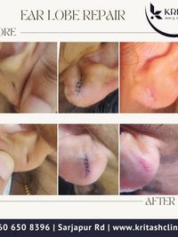 Minor Dermatological Surgery