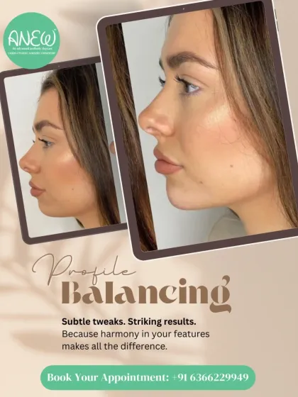 Profile balancing is about enhancing harmony with subtle tweaks. Using non-surgical enhancements like fillers, I bring symmetry to your facial profile for a naturally refined look.