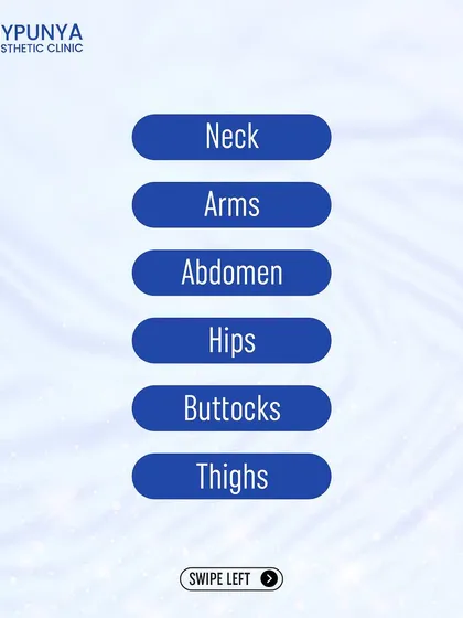 Liposuction can be performed on various parts of the body, including the neck, arms, abdomen, hips, buttocks, and thighs, to remove localized fat deposits.