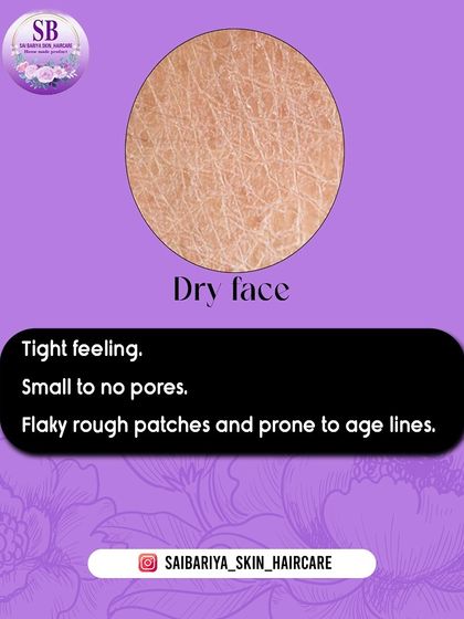 A visual representation of dry skin, which often feels tight and can have rough, flaky patches. Hydration and nourishment are key for this skin type.