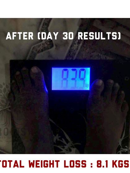 After: In just 30 days, he lost 8.1 kgs. This transformation highlights how an Ayurvedic lifestyle can correct metabolic issues caused by modern work life.