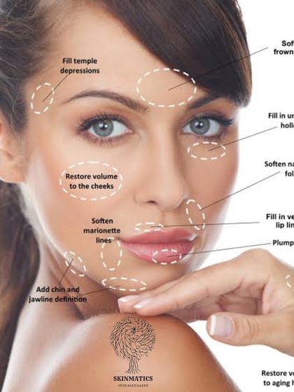 Skinmatics - Facial Aesthetics & Anti-Aging Dermal Fillers: Sculpt & Restore Volume photo 11