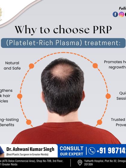 This graphic illustrates the key benefits of PRP treatment. It is a natural and safe procedure that promotes hair regrowth, strengthens weak follicles, and involves quick sessions with long-lasting benefits.