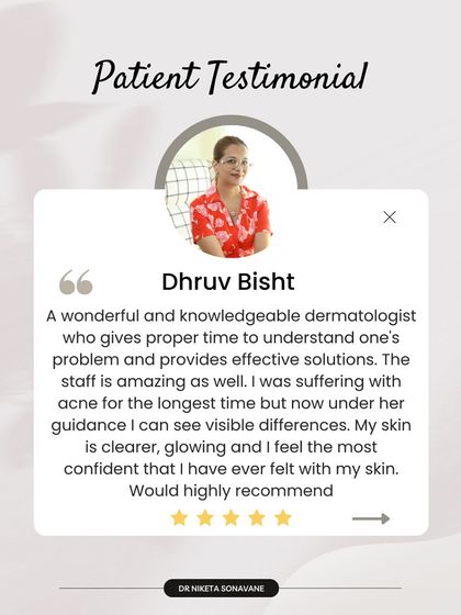 "My skin is clearer, glowing and I feel the most confident that I have ever felt." This is the ultimate goal for every patient. After a long struggle with acne, this patient's visible results are a testament to a guided, effective treatment plan.