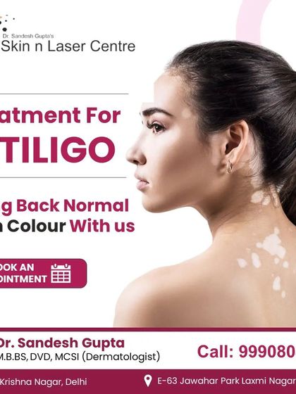 You can bring back your normal skin colour with the right treatment for Vitiligo. I use a combination of allopathic medicine and UVB therapy to get the best results for my patients.