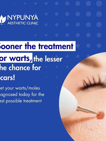 The sooner you seek treatment for warts or moles, the lesser the chance of scarring. Get any new or changing growths diagnosed by a dermatologist to ensure the best and safest removal treatment.