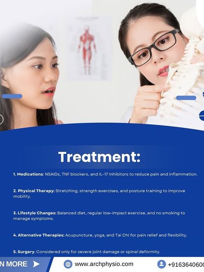 A physiotherapist explains treatment options for Ankylosing Spondylitis using a model of the spine. Our approach includes physical therapy with stretching, strength exercises, and posture training to improve mobility.