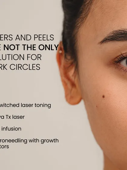 Fillers and peels are not the only solution for dark circles. I offer a range of advanced treatments like Q-switched laser toning, ADVA Tx, and PRP infusion to address this complex issue.