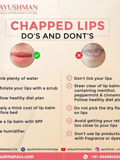 This helpful infographic provides essential do's and don'ts for managing chapped lips. Simple habits like staying hydrated and using SPF lip balm can make a huge difference for a healthier pout.