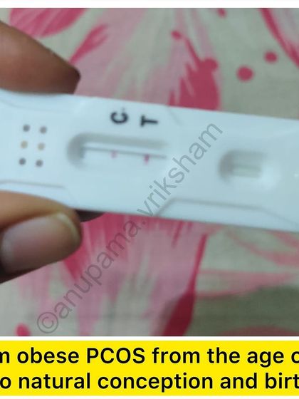 This student had obese PCOS from the age of 13 and a stressful job. By focusing on diet and exercise to regulate her periods, she was able to conceive naturally.