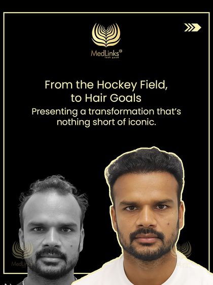 From the hockey field to hair goals. This collage showcases the iconic transformation of hockey player Lalit Upadhyay.