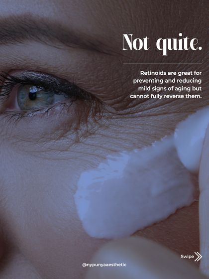 Not quite. Retinoids are excellent for preventing and reducing mild, early signs of aging, but they cannot fully reverse significant damage that lies deeper in the skin.