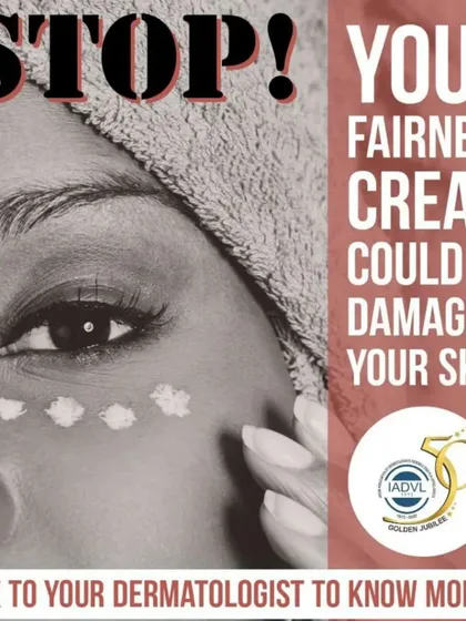 STOP. Many over the counter fairness creams contain ingredients that can cause irreversible damage to your skin, leading to issues like thinning, redness, and pigmentation. I strongly advise against using these products and can provide safe, effective alternatives based on a proper skin assessment.