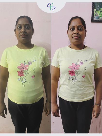 Rekha lost 9 kgs in 12 weeks after trying gym and yoga with no results. The right nutrition guidance made all the difference.