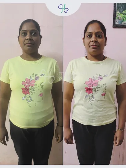 Rekha lost 9 kgs in 12 weeks after trying gym and yoga with no results. The right nutrition guidance made all the difference.