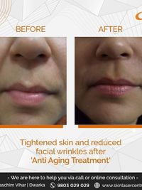 Aesthetic & Anti-Aging Dermatology