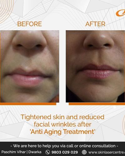 Aesthetic & Anti-Aging Dermatology