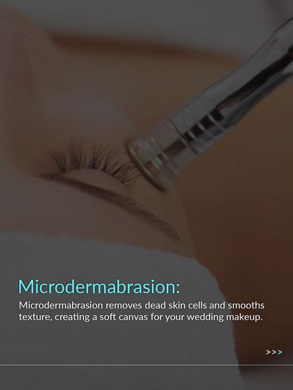 To create a perfect canvas for wedding makeup, we use microdermabrasion. This treatment removes dead skin cells and smooths texture, ensuring your makeup applies beautifully and lasts all day.