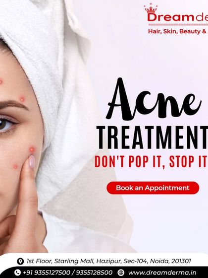 The first rule of acne treatment is "Don't pop it, stop it!". Popping pimples can lead to scarring and infection. Let our professionals handle your acne with safe, sterile, and effective procedures that prevent future damage.