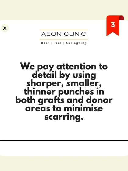 We pay close attention to detail in every procedure. For treatments like hair transplants, we use sharper, smaller, and thinner punches for both grafts and donor areas. This technique is crucial for minimizing scarring and achieving a natural-looking result.