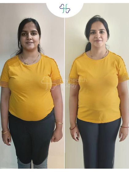 This before and after photo highlights the visible changes in Yashika's physique. My role was to keep her motivated and provide a simple plan that fit her new-mom lifestyle.