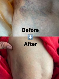 Physiotherapy for Senior Health & Mobility