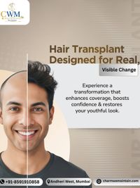 Hair Restoration