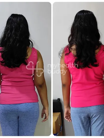 The back view of the same client's 6 kg weight loss. Building strength and clean eating habits were the foundation of her success.